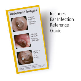 Safety 1ˢᵗ Ear Otoscope